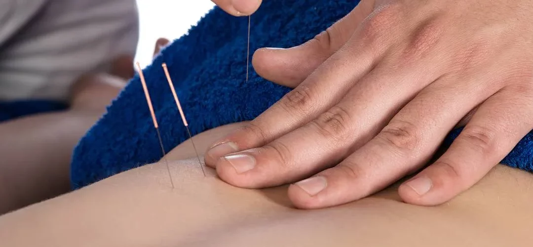 how does dry needling therapy work