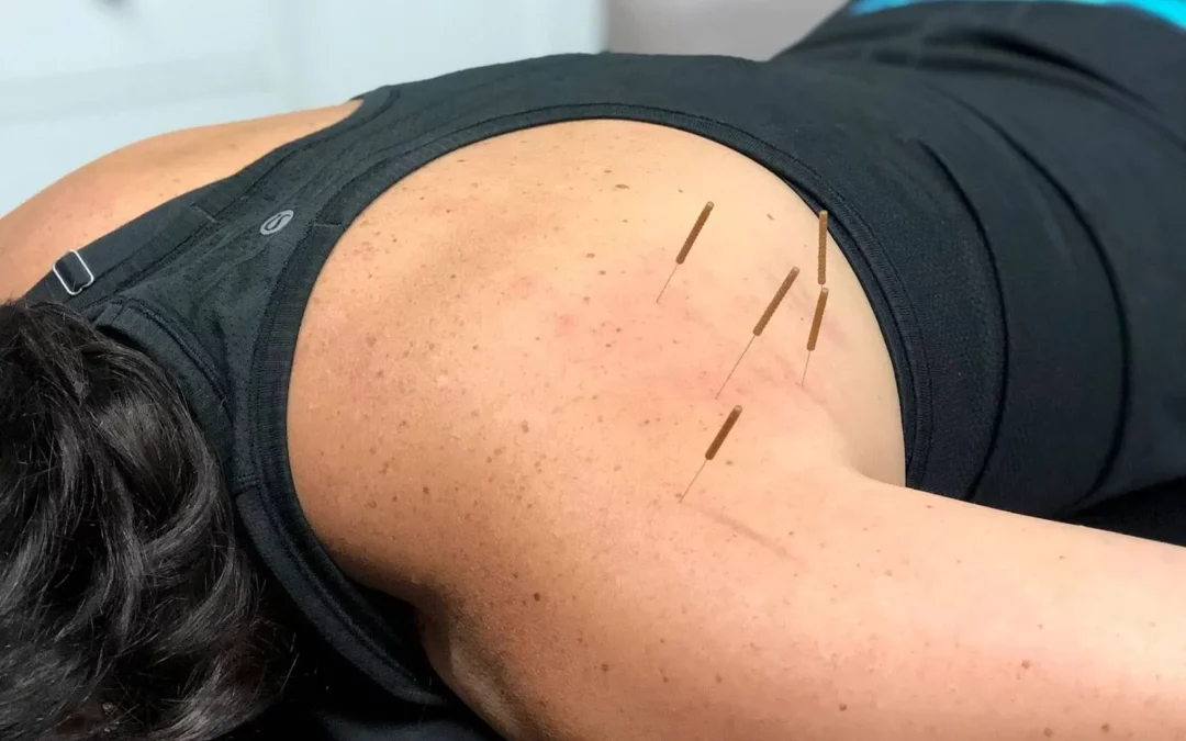 can dry needling cause more pain