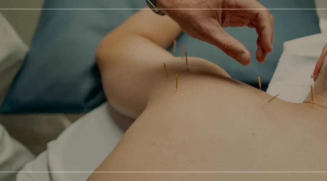 can dry needling make pain worse